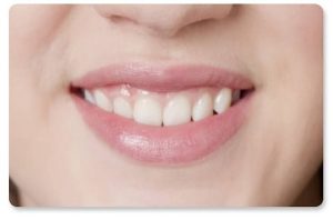 Cười hở lợi nên đánh son màu gì để che giấu hiệu quả?