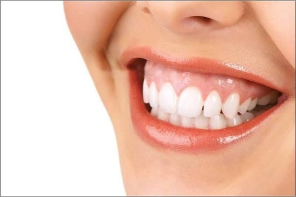 Nướu lộ khi cười là hiện tượng gì?