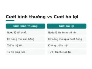 Cười bình thường vs Cười hở lợi