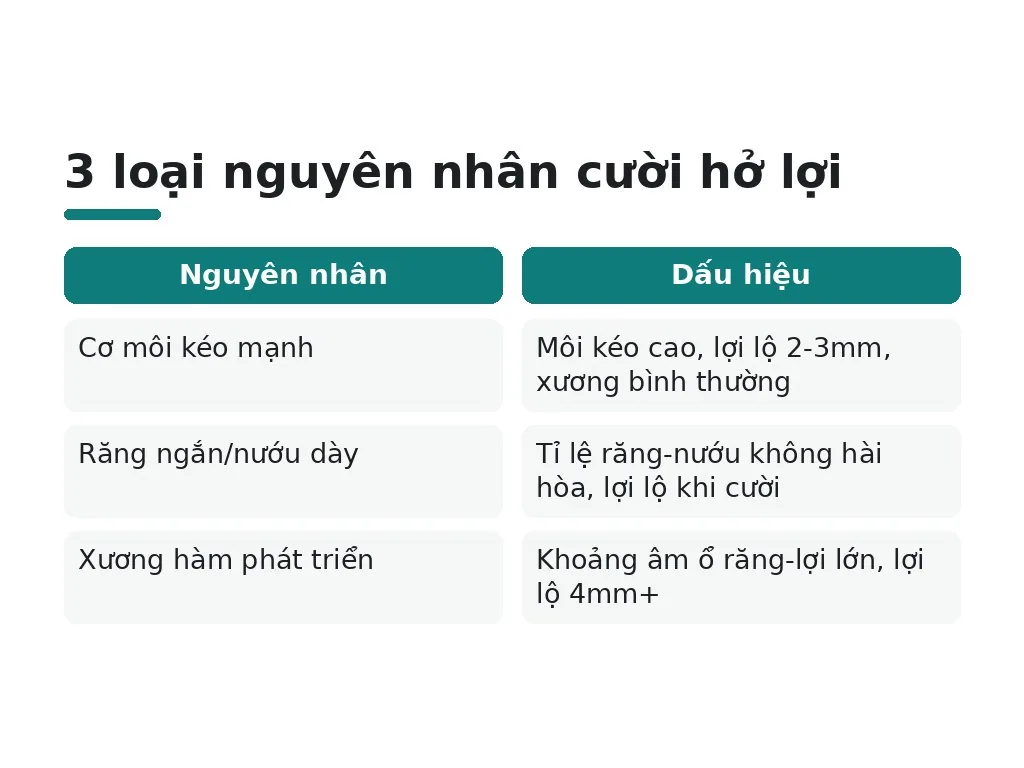 Cười hở lợi là gì và tại sao xảy ra?