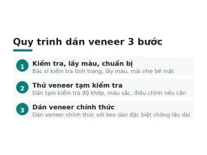 Quy trình dán veneer 3 bước