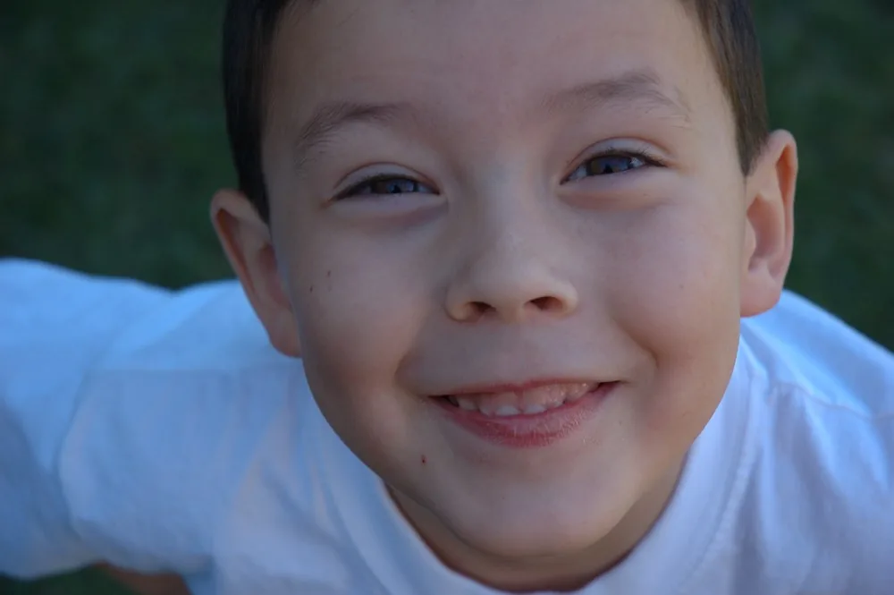 gummy smile genetics hereditary smile gum show