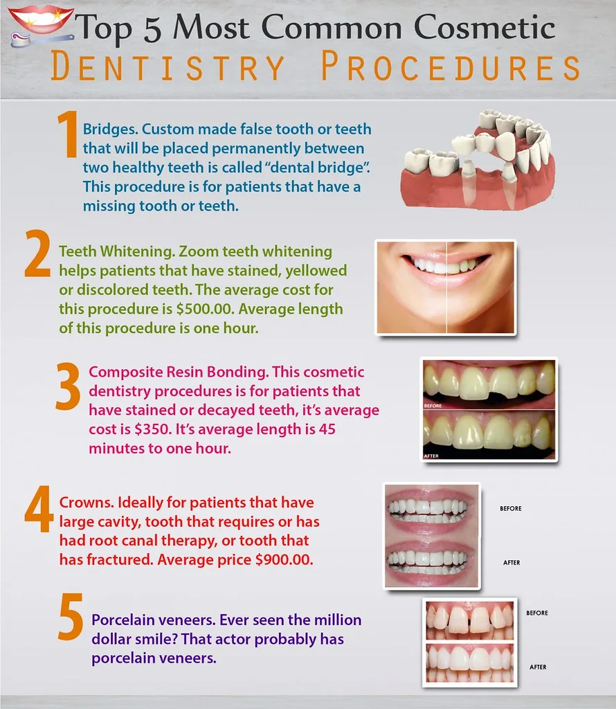 dental veneers porcelain veneers smile restoration cosmetic dentistry