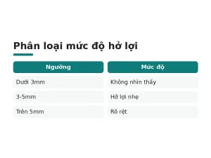 Phân loại mức độ hở lợi