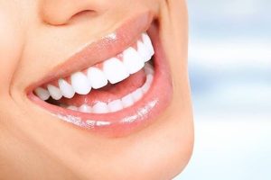 Tiêm botox cười hở lợi giữ được bao lâu? Hướng dẫn hiệu quả