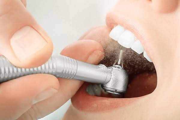 Đâu là các nguyên nhân khác gây hôi miệng ngoài cao răng?