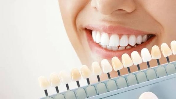 Tẩy trắng răng hoạt động như thế nào và tại sao không vĩnh viễn?